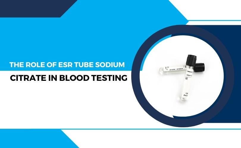 the Role of ESR Tube Sodium Citrate in Blood Testing